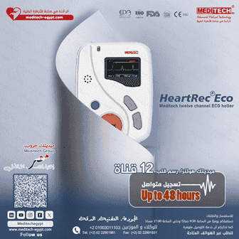 Holter 12-channel electrocardiogram