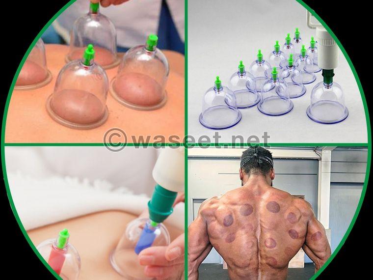 Special offer on cupping 0
